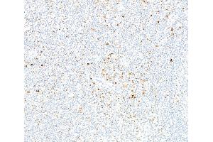 Immunohistochemistry (IHC) image for anti-Runt-Related Transcription Factor 2 (RUNX2) (AA 300-350) antibody (ABIN7795797)