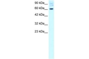 Western Blotting (WB) image for anti-Forkhead Box J2 (FOXJ2) antibody (ABIN2460611)