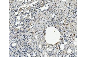 IHC analysis of SERPINA4 using anti-SERPINA4 antibody (ABIN7600083).