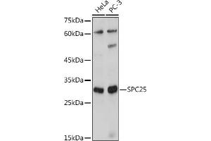 Western blot analysis of extracts of various cell lines, using SPC25 antibody (ABIN7270515) at 1:1000 dilution. (SPC25 Antikörper  (AA 1-224))