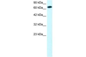Western Blotting (WB) image for anti-Signal Transducer and Activator of Transcription 4 (STAT4) antibody (ABIN2460707) (STAT4 Antikörper)