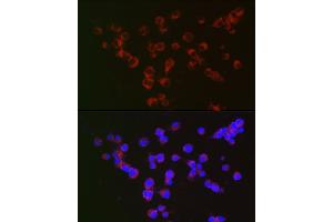 Immunofluorescence analysis of Neuro-2a cells using α-Synuclein Rabbit mAb (ABIN7270695) at dilution of 1:100 (40x lens).