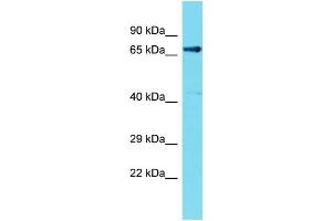 Host: Rabbit  Target Name: Fem1c  Sample Tissue: Rat Kidney lysates  Antibody Dilution: 1. (FEM1C Antikörper  (C-Term))