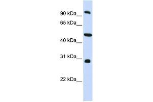 EML1 antibody used at 1 ug/ml to detect target protein.