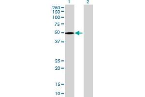 Western Blot analysis of C21orf2 expression in transfected 293T cell line by C21orf2 MaxPab polyclonal antibody. (C21orf2 Antikörper  (AA 1-375))