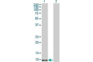 Western Blot analysis of ERAF expression in transfected 293T cell line by ERAF polyclonal antibody (A01). (aHSP Antikörper  (AA 1-102))