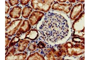 Immunohistochemistry of paraffin-embedded human kidney tissue using ABIN7156331 at dilution of 1:100 (Insulin Receptor Antikörper  (AA 1023-1298))