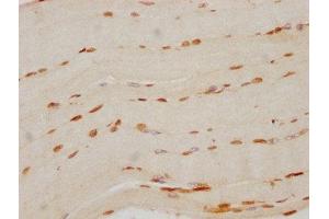 IHC image of ABIN7127502 diluted at 1:70 and staining in paraffin-embedded human skeletal muscle tissue performed on a Leica BondTM system. (Rekombinanter FTO Antikörper)