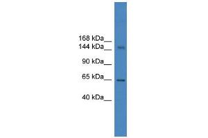 WB Suggested Anti-DHX57 Antibody Titration: 0. (DHX57 Antikörper  (C-Term))