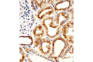 Immunohistochemical staining of paraffin-embedded human kidney section reacted with TUBB monoclonal antibody  at 1:25 dilution. (TUBB Antikörper)
