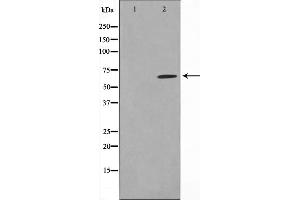Western blot analysis on NIH-3T3 cell lysate using CCDC99 Antibody,The lane on the left is treated with the antigen-specific peptide. (CCDC99 Antikörper  (C-Term))