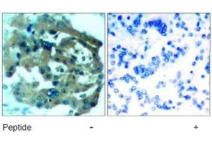 Image no. 1 for anti-Neurofibromin 2 (NF2) (AA 516-520) antibody (ABIN197520) (Merlin Antikörper  (AA 516-520))