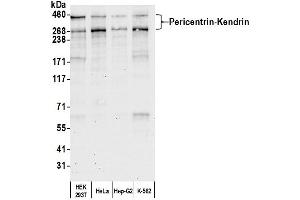 anti-Pericentrin (PCNT) (AA 175-225) antibody