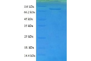SDS-PAGE (SDS) image for Complement Factor B (CFB) (AA 23-761) protein (His tag) (ABIN5709279)