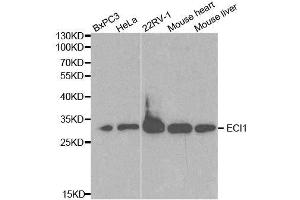 Western blot analysis of extracts of various cell lines, using ECI1 antibody.