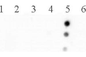 Histone H2B acetyl Lys120 pAb tested by dot blot analysis.