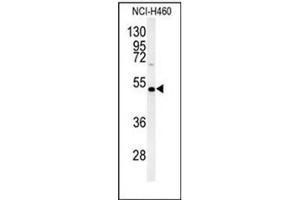 Western blot analysis of DGAT2 Antibody (N-term) in NCI-H460 cell line lysates (35ug/lane). (DGAT2 Antikörper  (N-Term))