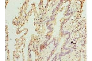 Immunohistochemistry of paraffin-embedded human lung tissue using ABIN7151467 at dilution of 1:100 (TPRKB Antikörper  (AA 1-175))