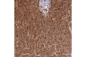 Immunohistochemical staining of human liver with DUS2L polyclonal antibody  shows strong cytoplasmic positivity in hepatocytes.