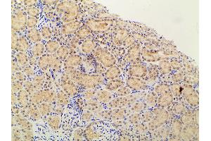 ABIN6267452 at 1/100 staining rat kidney tissue sections by IHC-P.