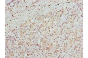 Immunohistochemistry of paraffin-embedded human pancreatic tissue using ABIN7154163 at dilution of 1:100 (GPD2 Antikörper  (AA 25-325))