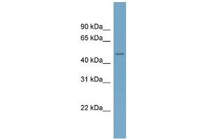 WB Suggested Anti-ACVR2B Antibody Titration:  0.