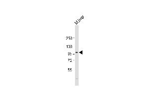 Anti-PROX-1- Antibody at 1:2000 dilution + mouse liver lysate Lysates/proteins at 20 μg per lane. (PROX1 Antikörper  (AA 492-520))