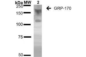 Western Blot analysis of Human Embryonic kidney epithelial cell line (HEK293) lysates showing detection of ~170 kDa GRP170 protein using Mouse Anti-GRP170 Monoclonal Antibody, Clone 6E3-2C2 (ABIN2868629). (HYOU1 Antikörper  (Atto 390))
