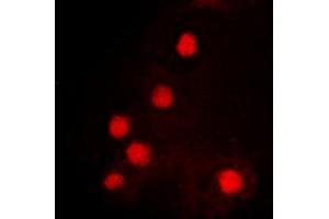 Immunofluorescent analysis of HOXC6 staining in K562 cells. (Homeobox C6 Antikörper  (C-Term))