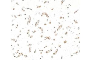Immunocytochemistry (ICC) image for anti-Jun Dimerization Protein 2 (JDP2) (AA 50-100) antibody (ABIN7795636) (Rekombinanter JDP2 Antikörper  (AA 50-100))