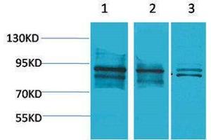 Western Blotting (WB) image for anti-Aryl Hydrocarbon Receptor Nuclear Translocator (ARNT) antibody (ABIN3181520) (ARNT Antikörper)