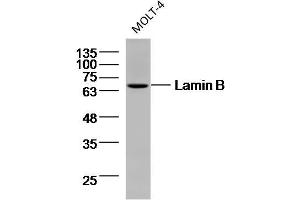 MOLT-4 cell lysates probed with Lamin B (9C11) Monoclonal Antibody, unconjugated (bsm-33040M) at 1:300 overnight at 4°C followed by a conjugated secondary antibody for 60 minutes at 37°C. (Lamin B Antikörper)