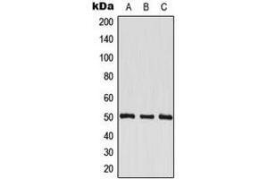 Western blot analysis of EEF1G expression in HeLa (A), HepG2 (B), HL60 (C) whole cell lysates. (EEF1G Antikörper  (Center))
