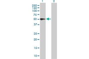 Western Blot analysis of PSG3 expression in transfected 293T cell line by PSG3 MaxPab polyclonal antibody. (PSG3 Antikörper  (AA 1-428))