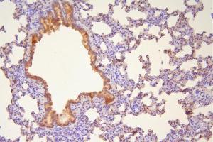 IHC analysis of Hsp20 using anti-Hsp20 antibody (ABIN5518920).