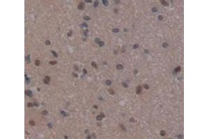 IHC-P analysis of Human Tissue, with DAB staining. (REPIN1 Antikörper  (AA 57-314))