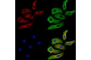 ABIN7094771 and ABIN7098822 staining Hela cells by IF/ICC. (SYNE1 Antikörper  (C-Term))