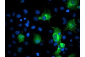 Anti-PFKP mouse monoclonal antibody (ABIN2455337) immunofluorescent staining of COS7 cells transiently transfected by pCMV6-ENTRY PFKP (RC200673). (PFKP Antikörper)