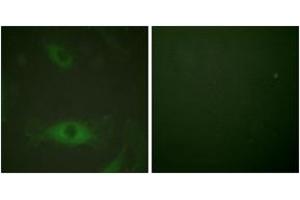 Immunofluorescence analysis of HeLa cells treated with TNF-a 20nM 15', using c-PLA2 (Phospho-Ser505) Antibody. (C-PLA2 (AA 471-520), (pSer505) Antikörper)