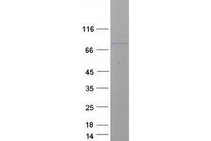 Validation with Western Blot