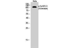 Western Blotting (WB) image for anti-EPH Receptor B1/2 (EPHB1/2) (pTyr594), (pTyr604) antibody (ABIN3182439) (EPHB1/2 Antikörper  (pTyr594, pTyr604))