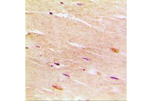 Immunohistochemical analysis of SERCA1 staining in human muscle formalin fixed paraffin embedded tissue section. (ATP2A1/SERCA1 Antikörper  (Center))