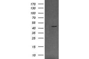 Image no. 4 for anti-Mitogen-Activated Protein Kinase Kinase 1 (MAP2K1) antibody (ABIN1499390) (MEK1 Antikörper)