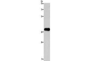 Western Blotting (WB) image for anti-Paired-Like Homeodomain 2 (PITX2) antibody (ABIN2422773) (PITX2 Antikörper)