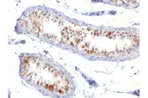 Formalin-fixed, paraffin-embedded human Testis stained with Melan-A / MART-1 Mouse Monoclonal Antibody (MLANA/788). (MLANA Antikörper)