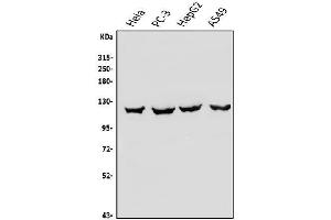 Western blot analysis of OAS3 using anti-OAS3 antibody (ABIN7602725).