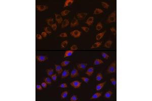 Immunofluorescence analysis of L929 cells using DLG1 Rabbit pAb (ABIN6130273, ABIN6139646, ABIN6139648 and ABIN6224636) at dilution of 1:100 (40x lens). (DLG1 Antikörper  (AA 1-190))