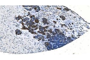IHC analysis of TMPRSS3 using anti-TMPRSS3 antibody (ABIN7601198). (TMPRSS3 Antikörper  (AA 3-454))