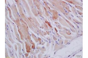 Formalin-fixed and paraffin embedded mouse stomach muscle labeled with Anti-HSPB7 Polyclonal Antibody, Unconjugated (ABIN1387071) at 1:200 followed by conjugation to the secondary antibody and DAB staining