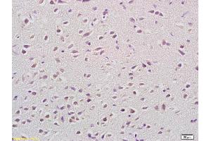 Formalin-fixed and paraffin embedded rat brain labeled with Anti-COX 5B Polyclonal Antibody, Unconjugated (ABIN751318) at 1:200 followed by conjugation to the secondary antibody and DAB staining (COX5B Antikörper  (AA 21-120))
